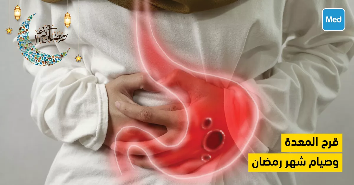 قرح المعدة وصيام شهر رمضان 